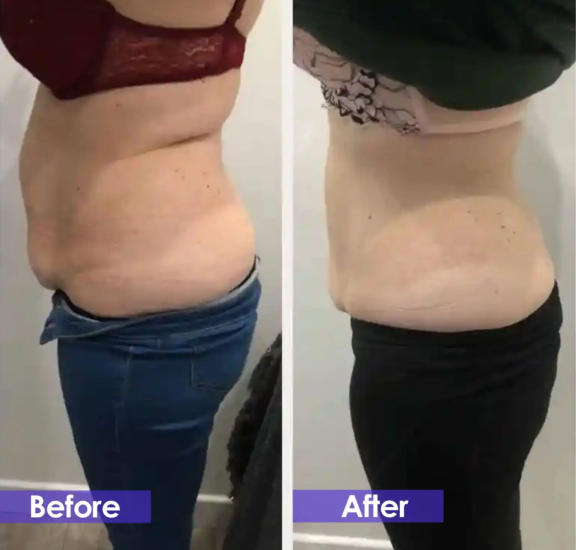 Before and after: female side profile with smaller waist measurement.